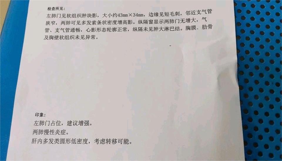 肝多发转移瘤